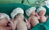 مادر جوان تبریزی در اولین زایمان خود چهار قلو به دنیا آورد