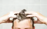 شامپو ضد شوره ومقابله با برخی از انواع ریزش مو